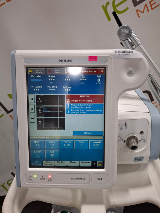 Philips Respironics V60 BiPAP Ventilator