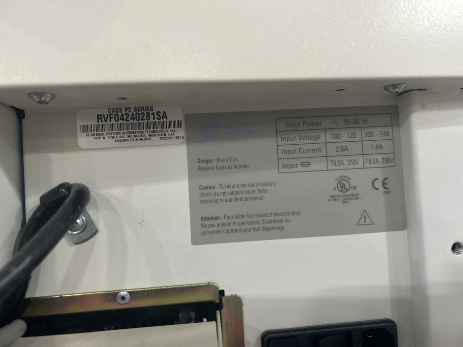 GE Healthcare Case P2 Stress Test Console