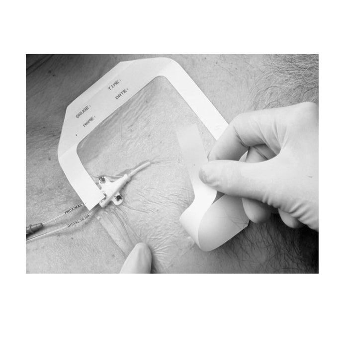 Solventum Corporation Solventum Corporation 1630 Frame Style Transparent Dressing 4" x Supplies reLink Medical