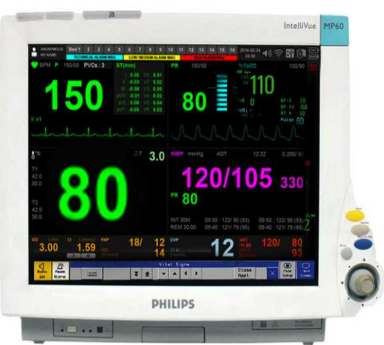 Philips IntelliVue MP60 Patient Monitor