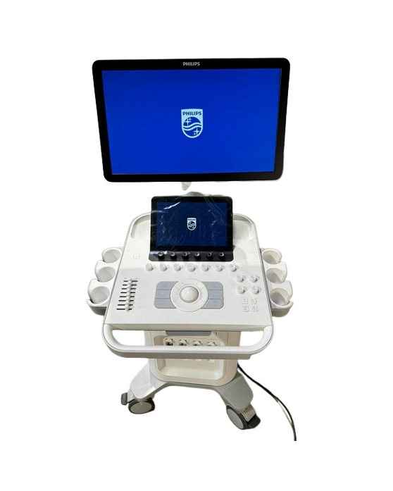Philips SDR 3000 Ultrasound