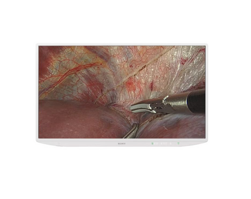 Sony Sony LMDXH550MD 55" 4K Medical Display  reLink Medical