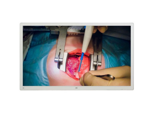LG H&H USA, Inc. LG 55MH5K-C 55" 4K Surgical Display 12G-SDI Support w/Protective Glass  reLink Medical