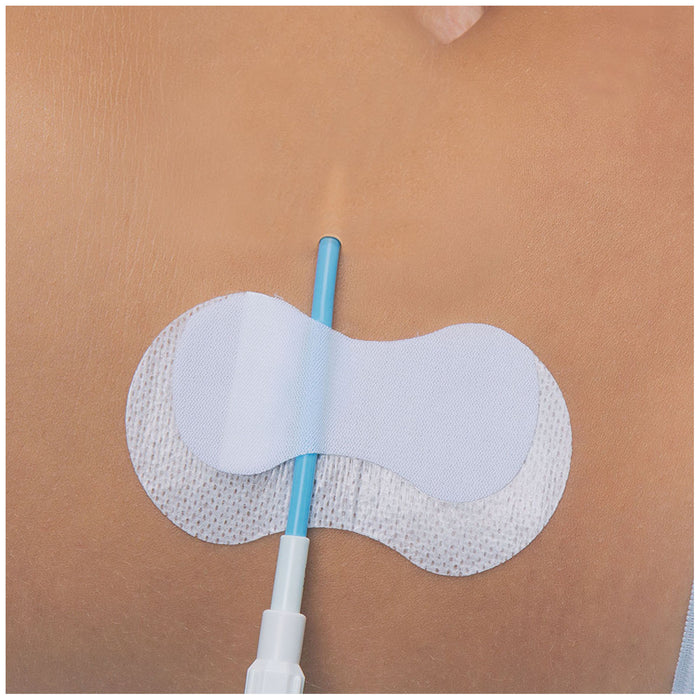 TIDI Products, LLC TIDI Products LLC 3601CVC Securement Device CVC Sterile Supplies reLink Medical