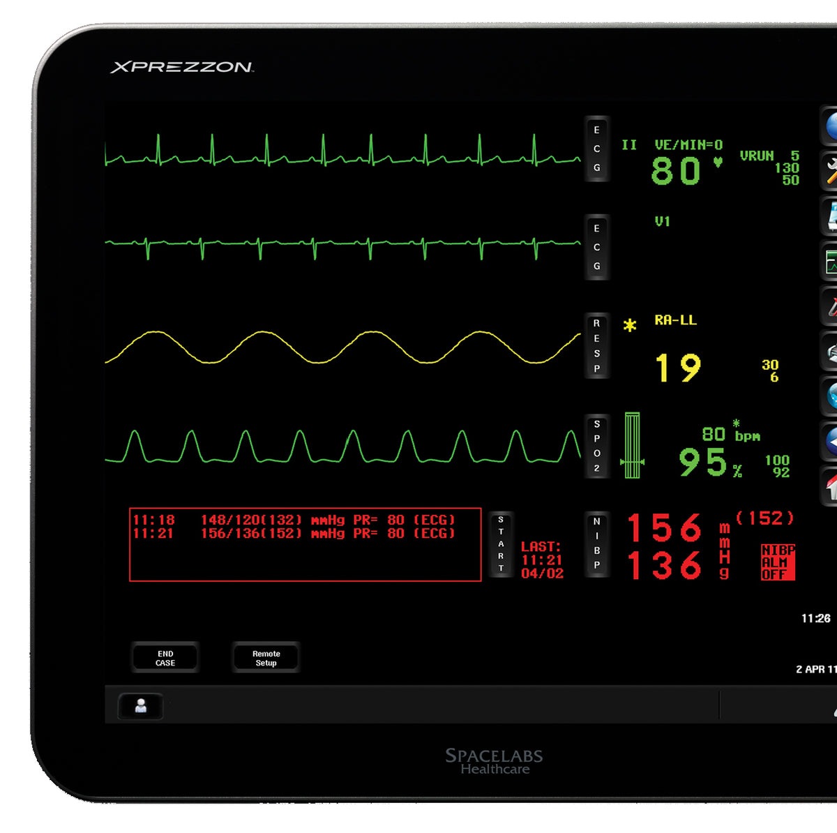 Spacelabs Ecg Machine Spacelabs 90431 ECG/BP/TEMP/CO Patient Monitor