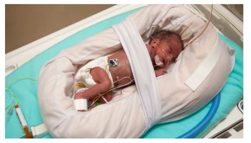 Molnlycke Health Care US, LLC Molnlycke Health Care US LLC 1400222 Small Tube Positioner with Supplies reLink Medical