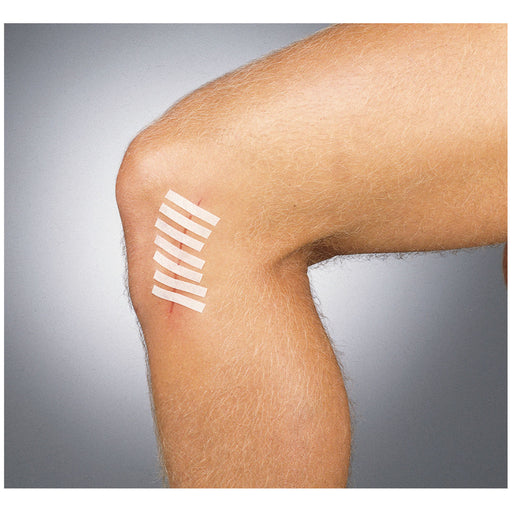 Gentell Gentell DKC71153 Wound Closure Strip ‚½" x 4" Non-Sterile Bulk Supplies reLink Medical