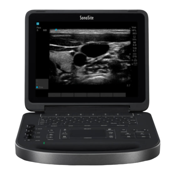 Fujifilm Sonosite Service Asssembly Display Kit, Edge II Total, P21147