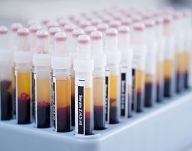 HORIBA Instruments, Inc. HORIBA Instruments Inc. 5390012458 Pointe Aspartate Aminotransferase Supplies reLink Medical