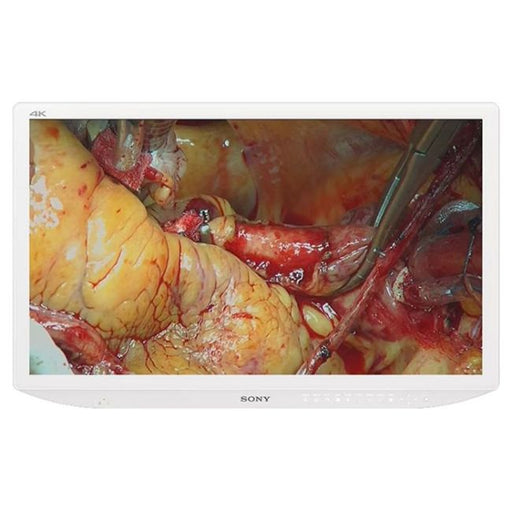 Sony Sony LMDX3200MD 32" 4K Medical Display, Dual AC/DC Power Cable  reLink Medical