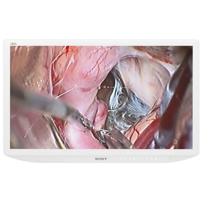 Sony Sony LMDX3200MD 32" 4K Medical Display, Dual AC/DC Power Cable  reLink Medical