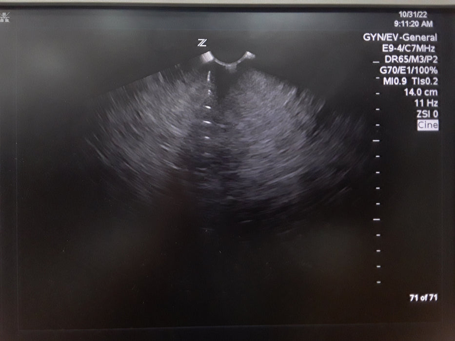 Zonare E9-4 Endovaginal Ultrasound Probe