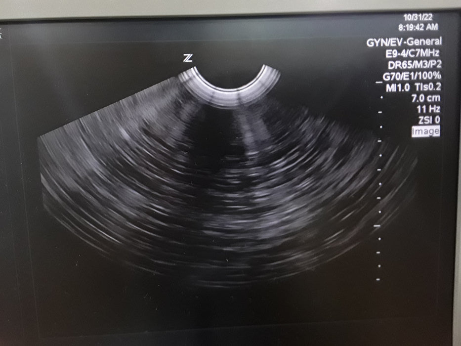 Zonare E9-4 Endovaginal Ultrasound Probe