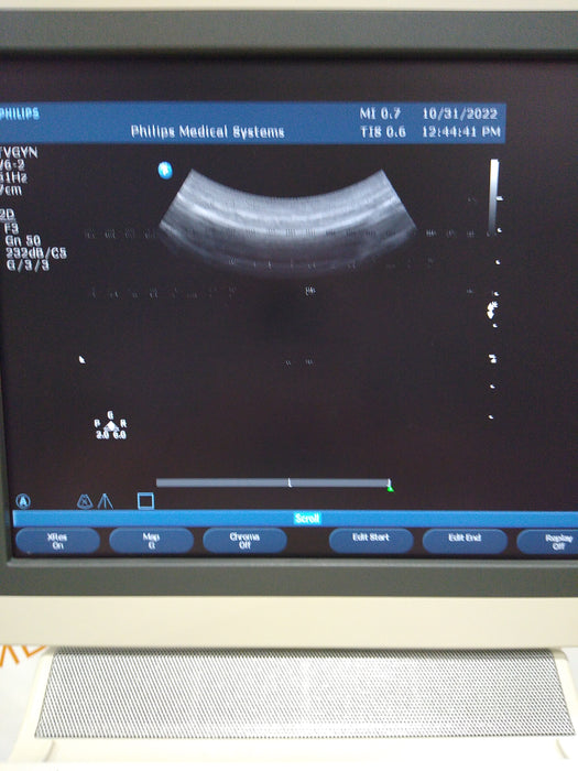 Philips Healthcare Philips Healthcare HD11XE Ultrasound System Ultrasound reLink Medical