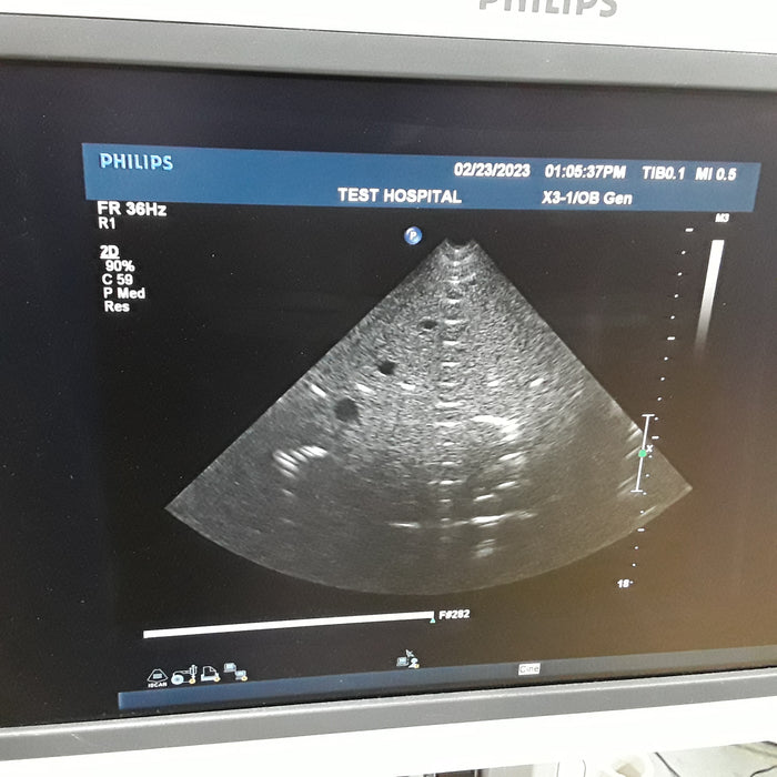Philips Healthcare X3-1 Broadband xMATRIX Array Ultrasound Probe