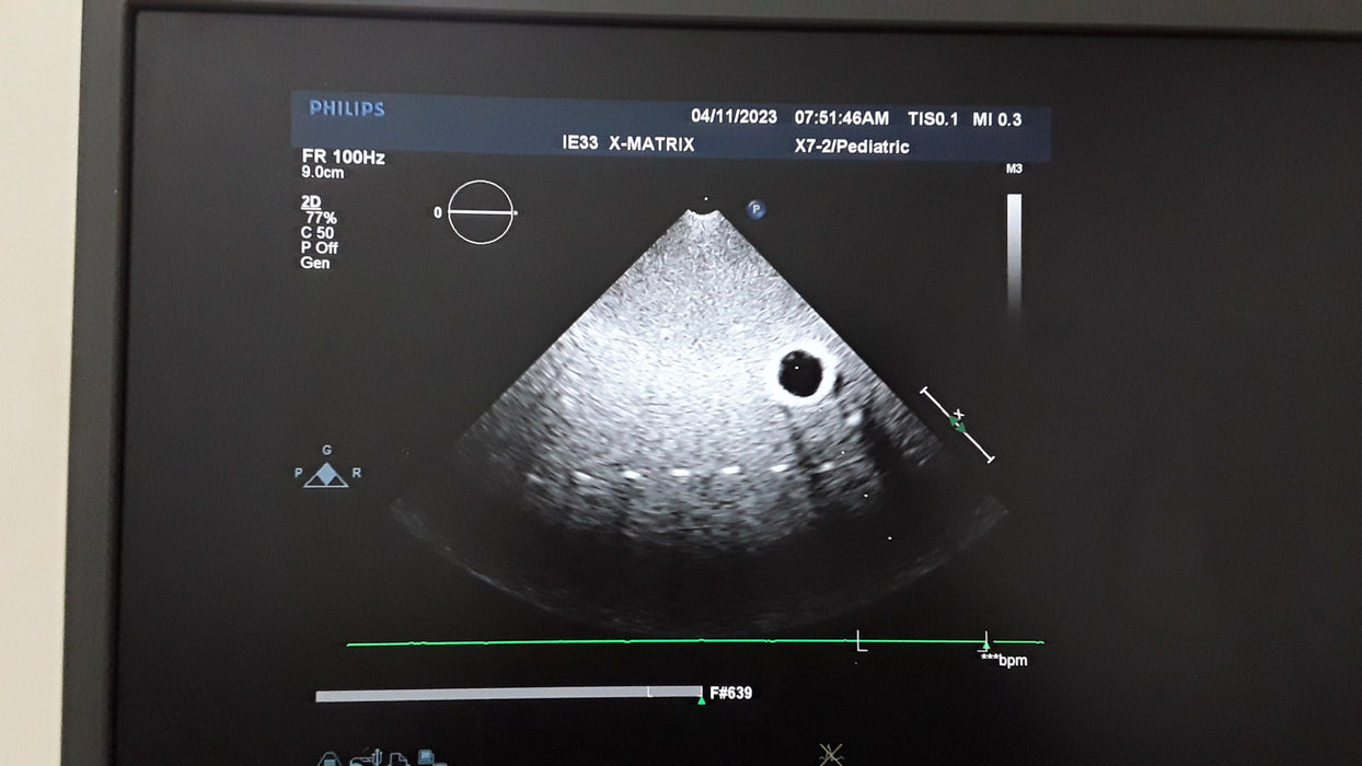 Philips Healthcare X7-2 Ultrasound Probe