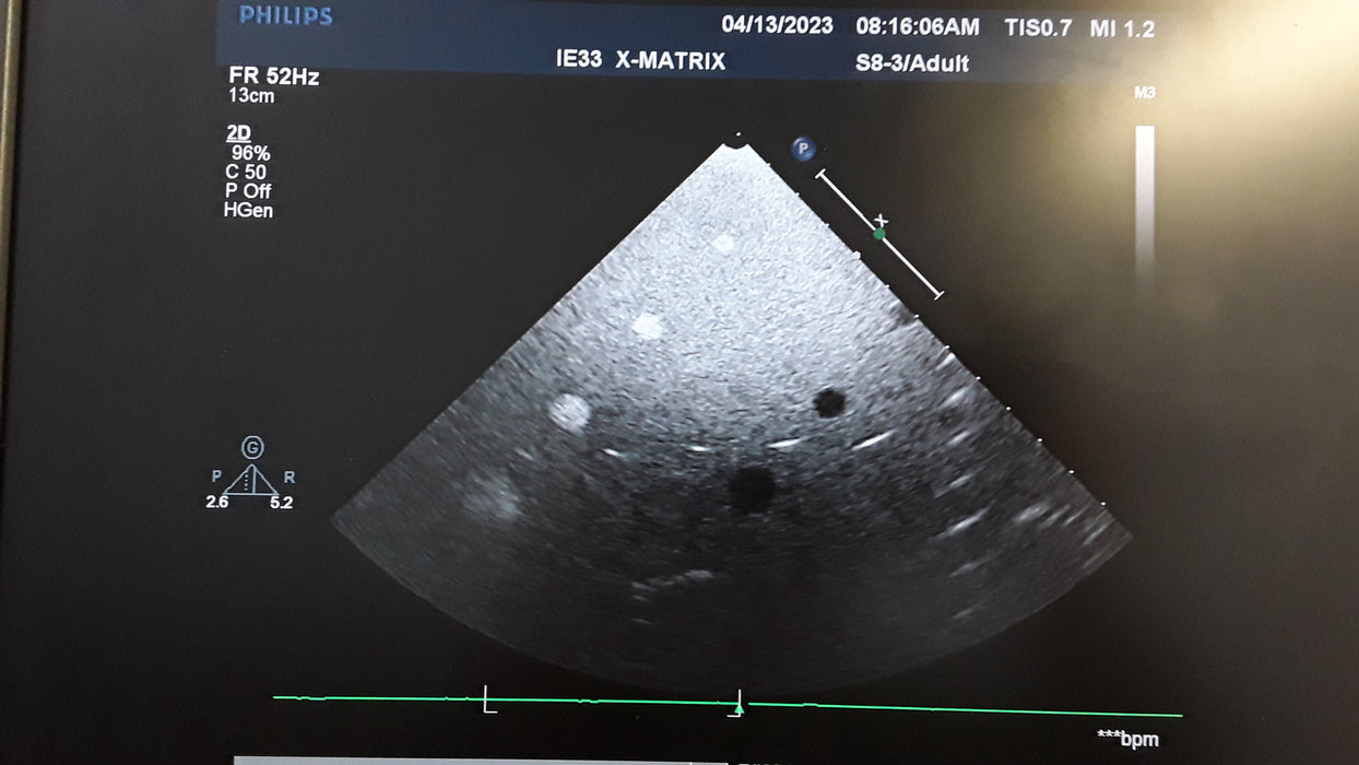 Philips Healthcare S8-3 Cardiac Sector Ultrasound Probe