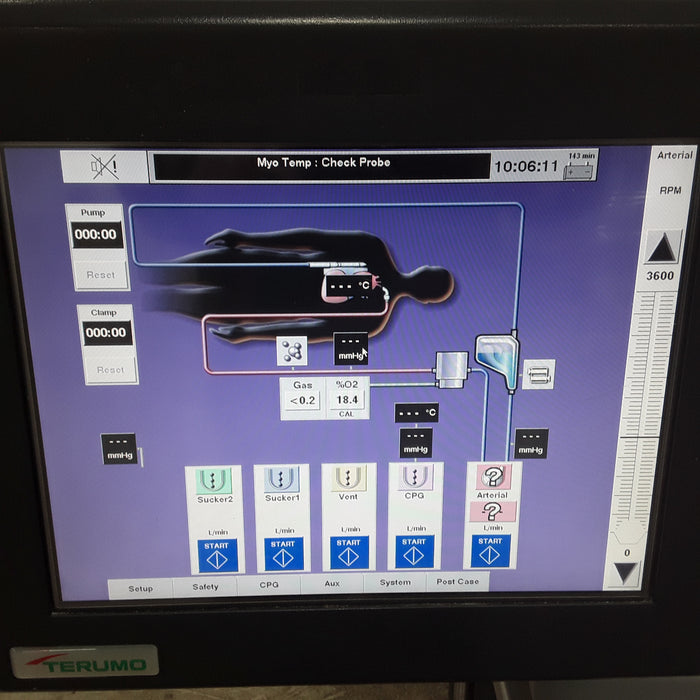 Terumo Medical Advanced Perfusion System 1 Perfusion System